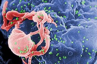 /nfts/arv-v2/330px-HIV-budding-Color.jpg